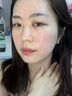 維特絲壬二酸祛痘藥膏煙酰胺凝膠去痘痘粉刺閉口男女水楊酸收毛孔青少年 曬單實(shí)拍圖