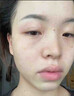 川廿制藥熊果苷乳膏醫用臉部凝膠精華美白淡斑提亮去黃改善暗沉膚色黑色素 曬單實(shí)拍圖