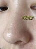 儒意（RUYI）紫蘇壬二酸清潔泥膜150g 面膜深層去黑頭收縮毛孔祛痘金榜第1名 曬單實(shí)拍圖