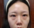 沃森博士眼貼膠原蛋白抗皺紋緊致去細紋眼袋補水保濕水凝膠貼片 曬單實(shí)拍圖