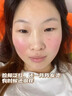 Newliann醫用械字號面膜冷敷貼醫美術(shù)后修復保濕補水曬后三型重組膠原蛋白 曬單實(shí)拍圖