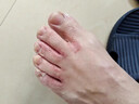 CNDK外用腳臭腳汽腳輕松噴霧劑足部腳癢水泡脫皮糜爛腳汗男女通用溫和 今日活動(dòng)【強效款-2盒療城裝】 曬單實(shí)拍圖