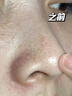 透真紫蘇清潔泥膜深層清潔去黑頭收縮毛孔祛痘曬后修復(fù)面膜補水保濕 曬單實拍圖
