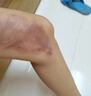 Newliann醫用重組三型人源化膠原蛋白外用人表皮生長(cháng)因子凝膠皮膚疤痕修復 曬單實(shí)拍圖