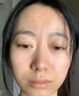 阿達帕林凝膠改善毛孔粗大去看黑頭醫(yī)用祛的痘消炎痤瘡硬疙瘩專用藥痘痘粉刺痘印治療粉刺膿包（視覺特效） 三盒裝【祛痘消炎 痤瘡膿包滿臉痘痘】熱賣款 曬單實拍圖