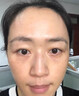 鼻背紋去除神器消除修復臉上鼻梁橫紋貼淡化山根眉間抬頭橫行皺紋祛額頭肌肉川字紋貼面霜 1瓶【體驗裝】 曬單實(shí)拍圖