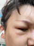 蒂佳婷（Dr.Jart）清潔黑丸面膜20片補(bǔ)水保濕控油去黑頭女生韓國(guó)進(jìn)口七夕情人節(jié)禮物 曬單實(shí)拍圖
