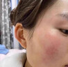 Newliann醫用重組三型人源化膠原蛋白乳液修復敷料凝膠人表皮生長(cháng)因子面霜 曬單實(shí)拍圖