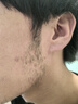 院線(xiàn)級810拉桿箱脫毛儀冰點(diǎn)激光脫毛光子嫩膚爆款家用美容院儀器 新款銀色810 雙風(fēng)扇 八靶條（高效推薦） 曬單實(shí)拍圖