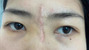 DIYKAUSR祛疤痕專(zhuān)用修復祛疤膏去疤痕凝膠醫用硅酮藥膏兒童燙傷膏疤克增生 手術(shù)燒燙控傷增生3支60g【99%顧客選擇療程裝】 曬單實(shí)拍圖