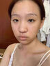 北京同仁堂痘印痘坑修復凹洞填充再生非藥乳膏祛痘印淡化消除男生去痘印痘疤 單盒【官方正品】 曬單實(shí)拍圖