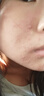 薇諾娜凈痘清顏3件套洗面奶爽膚水面霜水乳護膚品套裝七夕禮物 曬單實拍圖
