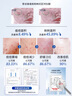 透真寡肽凍干粉精華液24瓶舒緩祛痘收縮毛孔提亮淡化痘印改善粉刺閉口 曬單實(shí)拍圖