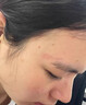 邦孚手祛疤膏去祛疤痕修復凝膠醫用醫院專(zhuān)用去疤膏硅酮去疤痕藥膏除疤膏 曬單實(shí)拍圖