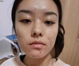 EDRI凍干粉修復屏障增厚角質(zhì)層術(shù)后醫修護褪紅速效補水敏肌2盒裝 曬單實(shí)拍圖