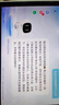 小度智能健康屏 定制版 【國家補貼】24h真人問診 視頻通話大屏音響 AI大模型音箱 遠程看護 家人禮物 曬單實拍圖
