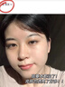 焦博士日本377祛斑霜美白淡化老年黃褐雀斑黑色素熊果苷乳膏去曬男女士 曬單實(shí)拍圖
