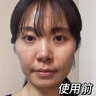 OHBT水楊酸祛痘面膜10片祛痘印修復(fù)痘坑毛孔收縮補水金榜第1名女男士 曬單實拍圖