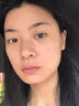 維特絲壬二酸祛痘藥膏煙酰胺凝膠去痘痘粉刺閉口男女水楊酸收毛孔青少年 曬單實(shí)拍圖