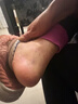 BEAI皸裂腳裂膏腳后跟防干裂皸裂龜裂開(kāi)裂凍裂膏護手足干裂潤膚霜 60g 曬單實(shí)拍圖