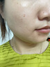 華美科左旋vc醫(yī)美精華液vc煙酰胺美白精華液祛斑淡化斑點(diǎn)去曬斑1瓶 曬單實(shí)拍圖