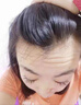Redact澳洲抬頭紋川字紋貼去除神器額頭皺紋貼去除男女抗皺緊致衰老專(zhuān)用 曬單實(shí)拍圖