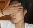 Newliann醫用重組三型人源化膠原蛋白外用人表皮生長(cháng)因子凝膠皮膚疤痕修復 曬單實(shí)拍圖