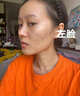 南京同仁堂祛痘膏去痘痘和痘印痘坑修復(fù)男女士改善粉刺閉口30g 曬單實(shí)拍圖