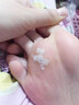 藤田制藥日本雞眼膏雞眼貼去根肉刺刺猴無(wú)痛脫落連根拔專(zhuān)用去腳跖疣20g 曬單實(shí)拍圖