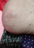 白云山馬油皸裂膏腳裂膏腳后跟干裂開(kāi)裂修護起皮保濕滋潤男女士全身可用 曬單實(shí)拍圖