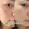 美美的天空熊果苷面膜抗皺緊致抗衰老補水淡斑提亮膚色祛黃改善暗沉男女士 熊果苷補水面膜1盒【共10片】 曬單實(shí)拍圖