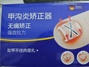 Borsu甲溝炎專(zhuān)用矯正器指甲矯正神器嵌甲腳趾甲矯正貼片正甲貼【10貼】 曬單實(shí)拍圖