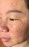 同仁堂美白祛斑霜祛斑美白淡斑黑色素去斑老年黃褐斑雀斑曬斑黑繃帶面霜 強(qiáng)效祛斑霜【3天全臉0斑】 曬單實(shí)拍圖