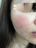 普門科技醫(yī)用大排燈美容儀紅藍(lán)黃光治療敏感肌痘痘痤瘡消炎七夕禮物送女友 光E【三光+12模式】 曬單實(shí)拍圖