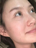 PNPN水楊酸祛痘面膜20片痘印控油祛痘毛孔收縮補水保濕男女士 曬單實拍圖