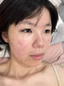 Newliann醫用械字號洗面奶狀潔面乳控油祛痘除螨蟲(chóng)去黑頭男士女士修復屏障 曬單實(shí)拍圖
