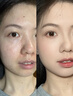 HIEUAILR德國品牌氨基酸美白洗面奶控油祛痘除螨蟲(chóng)去黑頭角質(zhì)男女士專(zhuān)用潔 一盒裝【美白祛痘控油】 曬單實(shí)拍圖