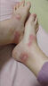 云南本草腳氣藥止癢脫皮爛腳丫真菌感染根100%草本足部抑菌腳臭專(zhuān)用的藥 買(mǎi)2發(fā)3【一噴見(jiàn)效】特噴霧劑效 草本水泡型治療真菌王凈克星膏 曬單實(shí)拍圖