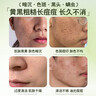 HIEUAILR德國氨基酸洗面奶男女士美白淡斑提亮膚色控油清潔毛孔祛痘潔面乳 兩盒裝【深層美白祛痘·不反黑】 曬單實(shí)拍圖