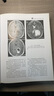 中樞神經(jīng)系統CT和MR鑒別診斷第3版 9787536953178 陜西科學(xué)技術(shù)出版社 魚(yú)博浪 曬單實(shí)拍圖