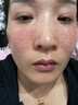 Aromat Herbs澳洲進(jìn)口美白祛斑乳液377煙酰胺去黃提亮滋潤補水保濕護膚品套裝 【美白淡斑】乳液+水+面霜+精華 曬單實(shí)拍圖