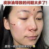 Newliann醫用械字號洗面奶狀潔面乳控油祛痘除螨蟲(chóng)去黑頭男士女士修復屏障 曬單實(shí)拍圖