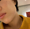 YYTISS祛痘藥膏淡化痘印消除坑炎痤瘡專(zhuān)用青少年去痘痘和痘印青春痘學(xué)生 曬單實(shí)拍圖