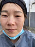 南京同仁堂美白祛斑霜50g去雀斑黃褐斑老年曬斑淡化黑色提亮膚色面霜男女士 3瓶輕度斑 【立省40】 曬單實拍圖