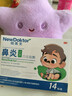 【德國品牌】 紐醫生 鼻炎貼兒童鼻貼鼻炎通鼻神器通氣鼻貼鼻竇炎砭貼過(guò)敏性鼻塞鼻癢 曬單實(shí)拍圖