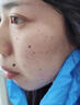 協(xié)南藥業(yè)去痣點(diǎn)痣膏祛痣點(diǎn)痣點(diǎn)疣藥水點(diǎn)痣醫用專(zhuān)用官方正品黑痣臉部不留疤 曬單實(shí)拍圖