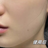 Newliann醫用重組人表皮生長(cháng)因子噴霧外用修復皮膚屏障凝膠原蛋白補水保濕 曬單實(shí)拍圖