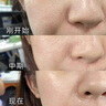 維特絲（vetes）去角質(zhì)面部啫喱控油保濕洗面奶男女士清潔毛孔黑頭閉口溫沒(méi)激素和 【6大專(zhuān)利】果酸去角質(zhì)啫喱200g 曬單實(shí)拍圖
