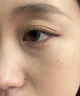 Newliann醫(yī)用重組三型人源化膠原蛋白外用人表皮生長因子凝膠皮膚疤痕修復(fù) 曬單實拍圖