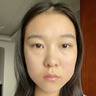 維特絲壬二酸祛痘藥膏煙酰胺凝膠去痘痘粉刺閉口男女水楊酸收毛孔青少年 曬單實(shí)拍圖